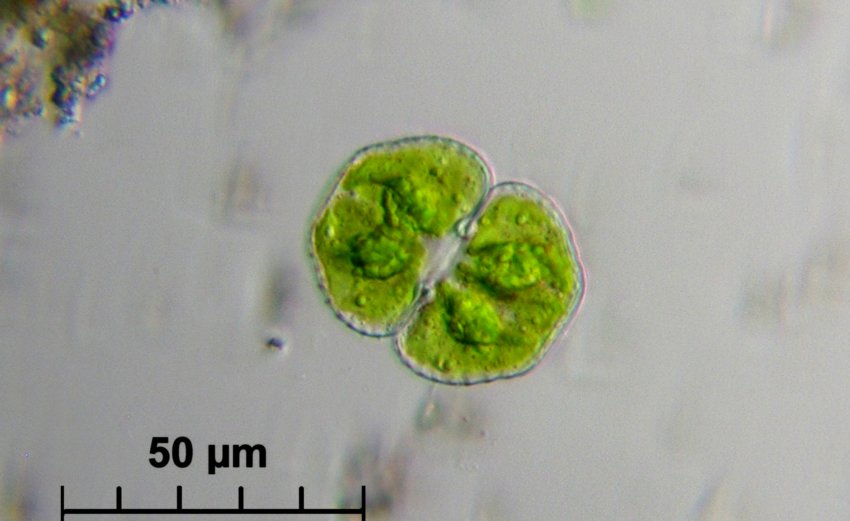 Cosmarium botrytis ? vari passaggi